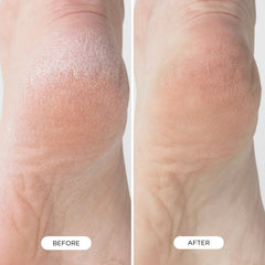 Foot Smooth Enzymatic Scrub
