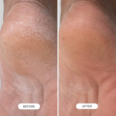 Foot Smooth Enzymatic Scrub